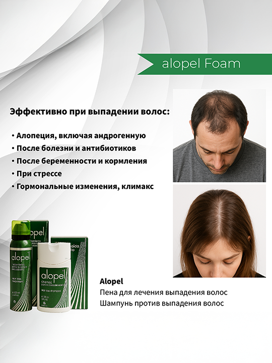 Alopel Foam 100ml – Advanced Anti-Hair Loss Treatment