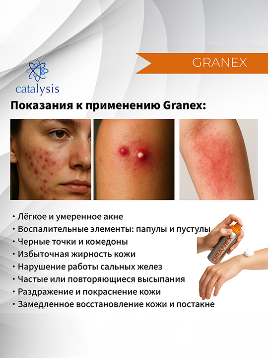 Granex foam - spray for acne-prone skin, 50 ml